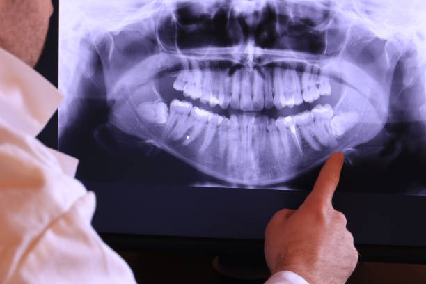 Best Urgent Care for Lost Fillings or Crowns in Key Largo, FL